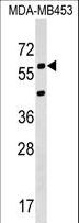 KCNS3 Antibody - KCNS3 Antibody western blot of MDA-MB453 cell line lysates (35 ug/lane). The KCNS3 antibody detected the KCNS3 protein (arrow).