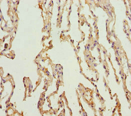 KCNS3 Antibody - Immunohistochemistry of paraffin-embedded human lung tissue at dilution 1:100