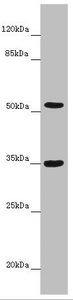 KCNS3 Antibody - Western blot All Lanes: KCNS3 antibody at 6.35 ug/ml+ Mouse lung tissue Secondary Goat polyclonal to rabbit IgG at 1/10000 dilution Predicted band size: 56 kDa Observed band size: 56,35 kDa