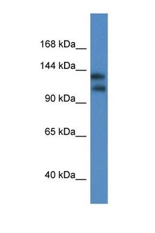 KCNT1 / KCa4.1 Antibody - KCNT1 / KCa4.1 antibody Western blot of Mouse Heart lysate. Antibody concentration 1 ug/ml. This image was taken for the unconjugated form of this product. Other forms have not been tested.
