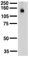 KCNT1 / KCa4.1 Antibody - Adult rat brain membrane probed with Anti-Slo2.2 Sodium-Activated K+ Channel Monoclonal Antibody.