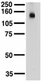 KCNT1 / KCa4.1 Antibody - Adult rat brain membrane probed with Anti-Slo2.2 Sodium-Activated K+ Channel Monoclonal Antibody.