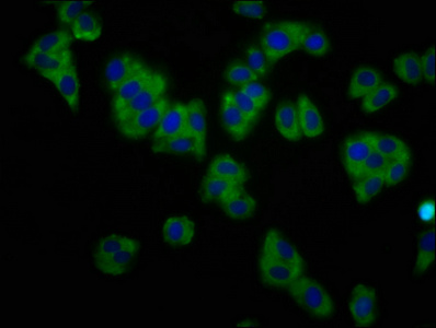 KCNT1 / KCa4.1 Antibody - Immunofluorescence staining of HepG2 cells at a dilution of 1:133, counter-stained with DAPI. The cells were fixed in 4% formaldehyde, permeabilized using 0.2% Triton X-100 and blocked in 10% normal Goat Serum. The cells were then incubated with the antibody overnight at 4 °C.The secondary antibody was Alexa Fluor 488-congugated AffiniPure Goat Anti-Rabbit IgG (H+L) .