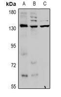 KCNT1 / KCa4.1 Antibody - Western blot analysis of KCNT1 expression in HepG2 (A), AML12 (B), C6 (C) whole cell lysates.