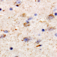 KCNT1 / KCa4.1 Antibody - Immunohistochemical analysis of KCNT1 staining in human brain formalin fixed paraffin embedded tissue section. The section was pre-treated using heat mediated antigen retrieval with sodium citrate buffer (pH 6.0). The section was then incubated with the antibody at room temperature and detected using an HRP conjugated compact polymer system. DAB was used as the chromogen. The section was then counterstained with haematoxylin and mounted with DPX.