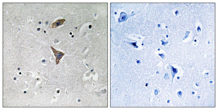 KCNT1 / KCa4.1 Antibody - Peptide - + Immunohistochemistry analysis of paraffin-embedded human brain tissue using KCNT1 antibody.