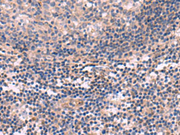 KCNT1 / KCa4.1 Antibody - Immunohistochemistry of paraffin-embedded Human tonsil tissue  using KCNT1 Polyclonal Antibody at dilution of 1:30(×200)