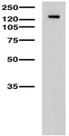 KCNT2 / KCa4.2 Antibody - Adult rat brain lysate