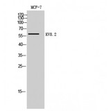 KCNV2 / Kv11.1 Antibody - Western blot of KV8.2 antibody