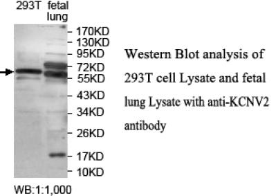 KCNV2 / Kv11.1 Antibody