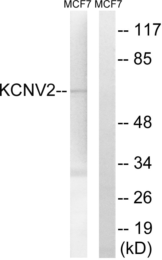 KCNV2 / Kv11.1 Antibody - Western blot analysis of lysates from MCF-7 cells, using KCNV2 Antibody. The lane on the right is blocked with the synthesized peptide.