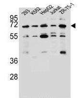 KCNV2 / Kv11.1 Antibody - KCNV2 Antibody western blot of 293,K562,HepG2,Jurkat,ZR-75-1 cell line lysates (35 ug/lane). The KCNV2 antibody detected the KCNV2 protein (arrow).