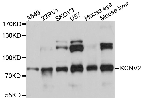 KCNV2 / Kv11.1 Antibody - Western blot analysis of extracts of various cell lines, using KCNV2 antibody at 1:1000 dilution. The secondary antibody used was an HRP Goat Anti-Rabbit IgG (H+L) at 1:10000 dilution. Lysates were loaded 25ug per lane and 3% nonfat dry milk in TBST was used for blocking. An ECL Kit was used for detection and the exposure time was 3s.