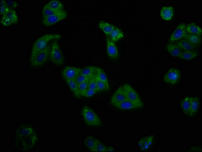 KCNV2 / Kv11.1 Antibody - Immunofluorescence staining of HepG2 cells at a dilution of 1:166, counter-stained with DAPI. The cells were fixed in 4% formaldehyde, permeabilized using 0.2% Triton X-100 and blocked in 10% normal Goat Serum. The cells were then incubated with the antibody overnight at 4 °C.The secondary antibody was Alexa Fluor 488-congugated AffiniPure Goat Anti-Rabbit IgG (H+L) .