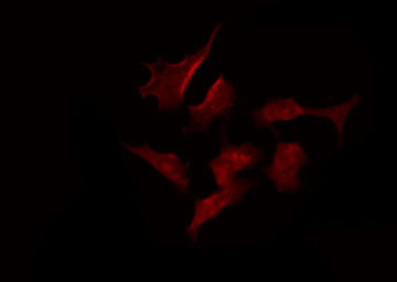 KCNV2 / Kv11.1 Antibody - Staining MCF-7 cells by IF/ICC. The samples were fixed with PFA and permeabilized in 0.1% Triton X-100, then blocked in 10% serum for 45 min at 25°C. The primary antibody was diluted at 1:200 and incubated with the sample for 1 hour at 37°C. An Alexa Fluor 594 conjugated goat anti-rabbit IgG (H+L) Ab, diluted at 1/600, was used as the secondary antibody.