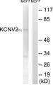 KCNV2 / Kv11.1 Antibody - Western blot analysis of extracts from MCF-7 cells, using KCNV2 antibody.