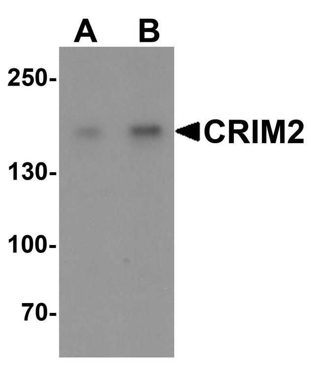 KCP / CRIM2 Antibody - Western blot analysis of CRIM2 in Jurkat cell lysate with CRIM2 antibody at (A) 1 and (B) 2 ug/ml.