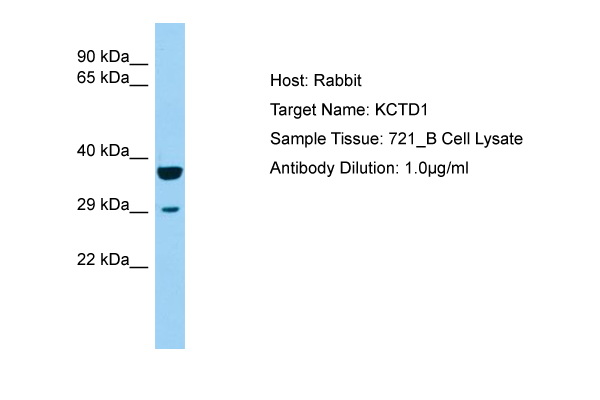 KCTD1 Antibody -  This image was taken for the unconjugated form of this product. Other forms have not been tested.