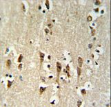 KCTD1 Antibody - KCTD1 Antibody IHC of formalin-fixed and paraffin-embedded brain tissue followed by peroxidase-conjugated secondary antibody and DAB staining.