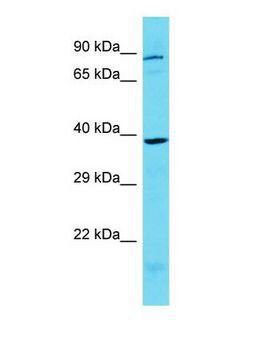 KCTD1 Antibody - Western blot of KCTD1 Antibody - C-terminal region with human MCF7 cells lysate.  This image was taken for the unconjugated form of this product. Other forms have not been tested.