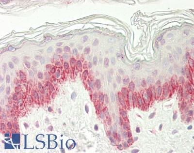 KCTD1 Antibody - Human Skin: Formalin-Fixed, Paraffin-Embedded (FFPE)