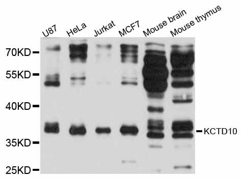 KCTD10 Antibody - Western blot analysis of extracts of various cell lines, using KCTD10 antibody at 1:3000 dilution. The secondary antibody used was an HRP Goat Anti-Rabbit IgG (H+L) at 1:10000 dilution. Lysates were loaded 25ug per lane and 3% nonfat dry milk in TBST was used for blocking. An ECL Kit was used for detection and the exposure time was 30s.