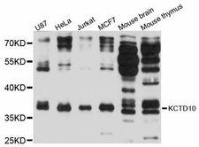KCTD10 Antibody - Western blot analysis of extracts of various cell lines, using KCTD10 antibody at 1:3000 dilution. The secondary antibody used was an HRP Goat Anti-Rabbit IgG (H+L) at 1:10000 dilution. Lysates were loaded 25ug per lane and 3% nonfat dry milk in TBST was used for blocking. An ECL Kit was used for detection and the exposure time was 30s.
