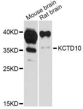 KCTD10 Antibody - Western blot analysis of extracts of various cell lines, using KCTD10 Antibody at 1:3000 dilution. The secondary antibody used was an HRP Goat Anti-Rabbit IgG (H+L) at 1:10000 dilution. Lysates were loaded 25ug per lane and 3% nonfat dry milk in TBST was used for blocking. An ECL Kit was used for detection and the exposure time was 30s.