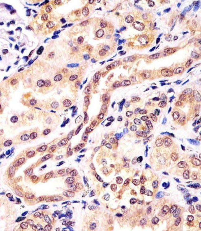 KCTD11 Antibody - Antibody staining KCTD11 in human kidney tissue sections by Immunohistochemistry (IHC-P - paraformaldehyde-fixed, paraffin-embedded sections). Tissue was fixed with formaldehyde and blocked with 3% BSA for 0. 5 hour at room temperature; antigen retrieval was by heat mediation with a citrate buffer (pH 6). Samples were incubated with primary antibody (1:25) for 1 hours at 37°C. A undiluted biotinylated goat polyvalent antibody was used as the secondary antibody.
