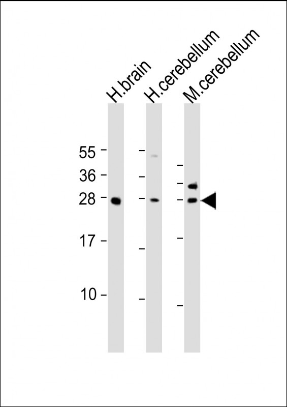 KCTD11 Antibody - All lanes: Anti-KCTD11 Antibody (N-Term) at 1:1000-1:2000 dilution. Lane 1: human brain lysate. Lane 2: human cerebellum lysate. Lane 3: mouse cerebellum lysate Lysates/proteins at 20 ug per lane. Secondary Goat Anti-Rabbit IgG, (H+L), Peroxidase conjugated at 1:10000 dilution. Predicted band size: 26 kDa. Blocking/Dilution buffer: 5% NFDM/TBST.