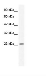 KCTD11 Antibody - HepG2 Cell Lysate.  This image was taken for the unconjugated form of this product. Other forms have not been tested.