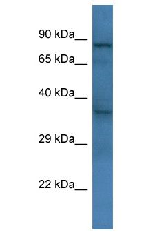 KCTD12 Antibody - KCTD12 antibody Western Blot of Mouse Kidney. Antibody dilution: 1 ug/ml.  This image was taken for the unconjugated form of this product. Other forms have not been tested.
