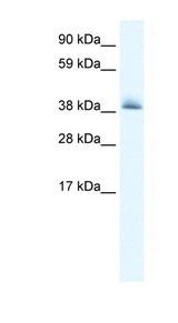 KCTD13 Antibody - KCTD13 antibody Western blot of Fetal heart lysate. This image was taken for the unconjugated form of this product. Other forms have not been tested.