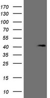 KCTD13 Antibody - HEK293T cells were transfected with the pCMV6-ENTRY control. (Left lane) or pCMV6-ENTRY KCTD13. (Right lane) cDNA for 48 hrs and lysed. Equivalent amounts of cell lysates. (5 ug per lane) were separated by SDS-PAGE and immunoblotted with anti-KCTD13. (1:2000)