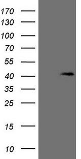KCTD13 Antibody - HEK293T cells were transfected with the pCMV6-ENTRY control. (Left lane) or pCMV6-ENTRY KCTD13. (Right lane) cDNA for 48 hrs and lysed