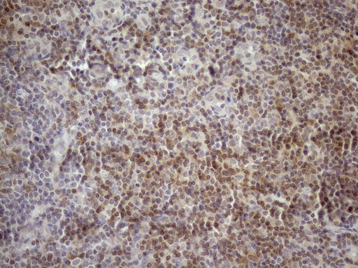 KCTD13 Antibody - Immunohistochemical staining of paraffin-embedded Human tonsil within the normal limits using anti-KCTD13 mouse monoclonal antibody. (Heat-induced epitope retrieval by 1mM EDTA in 10mM Tris buffer. (pH8.5) at 120°C for 3 min. (1:150)
