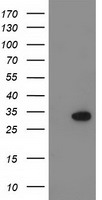 KCTD14 Antibody - HEK293T cells were transfected with the pCMV6-ENTRY control (Left lane) or pCMV6-ENTRY KCTD14 (Right lane) cDNA for 48 hrs and lysed. Equivalent amounts of cell lysates (5 ug per lane) were separated by SDS-PAGE and immunoblotted with anti-KCTD14.