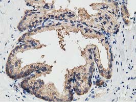 KCTD14 Antibody - IHC of paraffin-embedded Human prostate tissue using anti-KCTD14 mouse monoclonal antibody. (Heat-induced epitope retrieval by 10mM citric buffer, pH6.0, 100C for 10min).