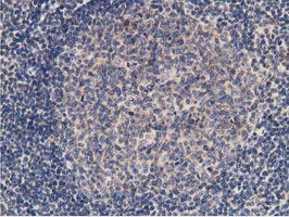 KCTD14 Antibody - IHC of paraffin-embedded Human lymph node tissue using anti-KCTD14 mouse monoclonal antibody. (Heat-induced epitope retrieval by 10mM citric buffer, pH6.0, 100C for 10min).