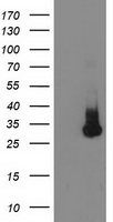 KCTD14 Antibody - HEK293T cells were transfected with the pCMV6-ENTRY control (Left lane) or pCMV6-ENTRY KCTD14 (Right lane) cDNA for 48 hrs and lysed. Equivalent amounts of cell lysates (5 ug per lane) were separated by SDS-PAGE and immunoblotted with anti-KCTD14.