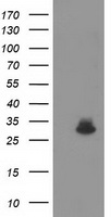 KCTD14 Antibody - HEK293T cells were transfected with the pCMV6-ENTRY control (Left lane) or pCMV6-ENTRY KCTD14 (Right lane) cDNA for 48 hrs and lysed. Equivalent amounts of cell lysates (5 ug per lane) were separated by SDS-PAGE and immunoblotted with anti-KCTD14.