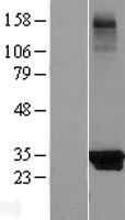 KCTD14 Protein - Western validation with an anti-DDK antibody * L: Control HEK293 lysate R: Over-expression lysate