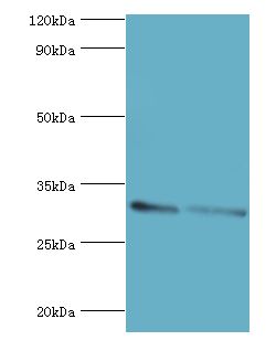 KCTD15 Antibody - Western blot. All lanes: KCTD15 antibody at 8 ug/ml. Lane 1: 293T whole cell lysate. Lane 2: HeLa whole cell lysate. Secondary antibody: Goat polyclonal to rabbit at 1:10000 dilution. Predicted band size: 32 kDa. Observed band size: 32 kDa Immunohistochemistry.
