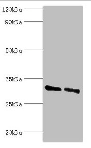 KCTD15 Antibody - Western blot All lanes: KCTD15 antibody at 8µg/ml Lane 1: 293T whole cell lysate Lane 2: Hela whole cell lysate Secondary Goat polyclonal to rabbit IgG at 1/10000 dilution Predicted band size: 32, 27 kDa Observed band size: 32 kDa