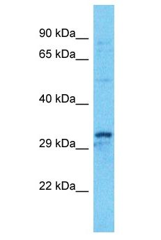 KCTD15 Antibody - KCTD15 antibody Western Blot of HT1080. Antibody dilution: 1 ug/ml.  This image was taken for the unconjugated form of this product. Other forms have not been tested.