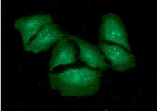 KCTD15 Antibody - ICC/IF analysis of KCTD15 in HeLa cells. The cell was stained with KCTD15 antibody (1:100).The secondary antibody (green) was used Alexa Fluor 488.