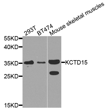 KCTD15 Antibody - Western blot analysis of extract of various cells.