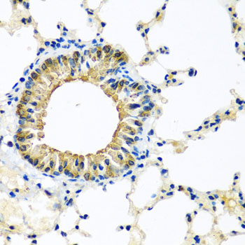 KCTD15 Antibody - Immunohistochemistry of paraffin-embedded mouse lung tissue.