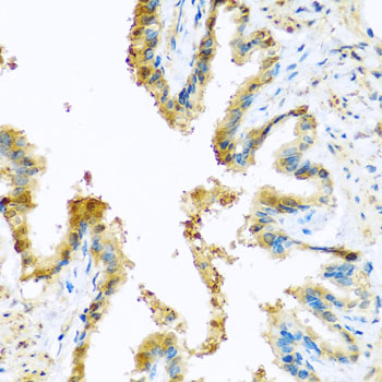 KCTD15 Antibody - Immunohistochemistry of paraffin-embedded rat lung tissue.