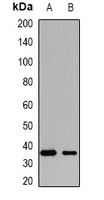 KCTD15 Antibody - Western blot analysis of KCTD15 expression in HEK293T (A); mouse skeletal muscles (B) whole cell lysates.